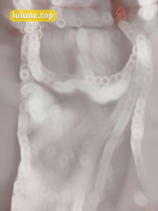 如何看待抖音网红大鹅gaga(大鹅姐姐)微密圈资源（探索大鹅gaga微密圈内容）