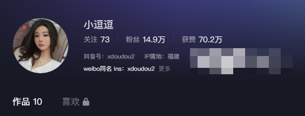 小逗逗微密圈图展现,如同醇香美酒一般!