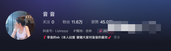 抖音音音微密圈的穿搭作品好不好看–取决于个人审美观