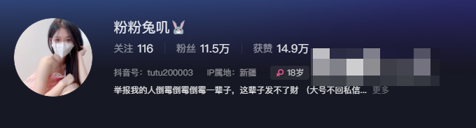 抖音网红粉粉兔叽微密圈精选资源如何获取?